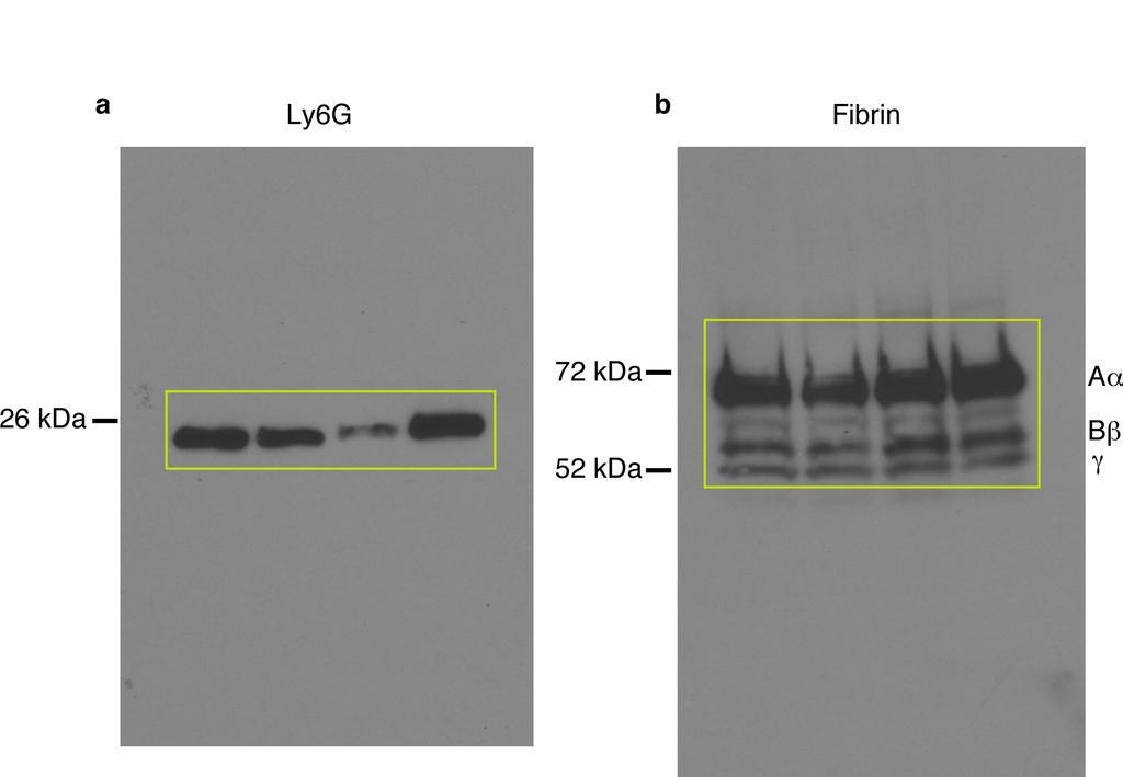 Supplementary Figure 8. Full Western blots for Fig. 7g.