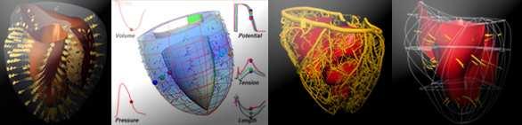 A few images Whole heart model: Physiome project Models of electrical activation and myocardial