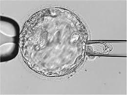 Embryo Selection for Transfer Preimplantation Genetic Testing - PGT- A (aneuploidy) 23 PAIRS OF CHROMOSOMES?
