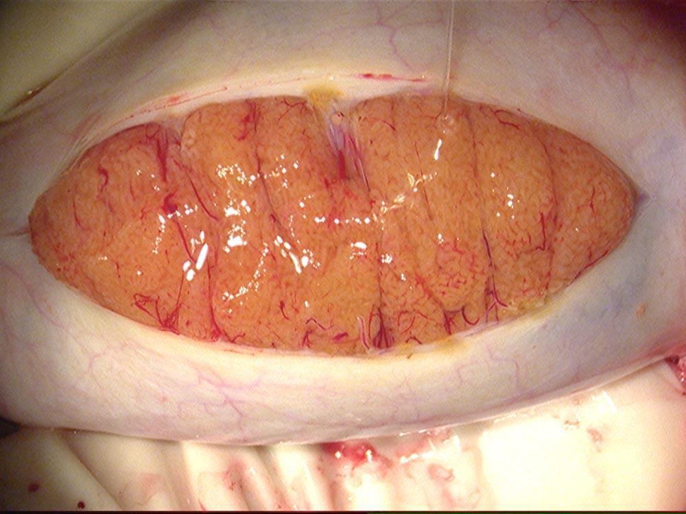 Normal Testis: Note Similarity of Tunica