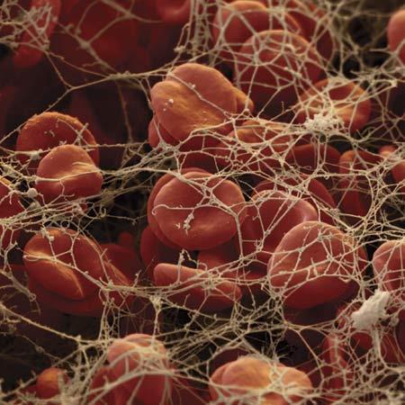 Blood platelets will become activated when collagen enters bloodstream.