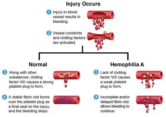 clotting cascade *Hemophiliacs don t produce factor 8