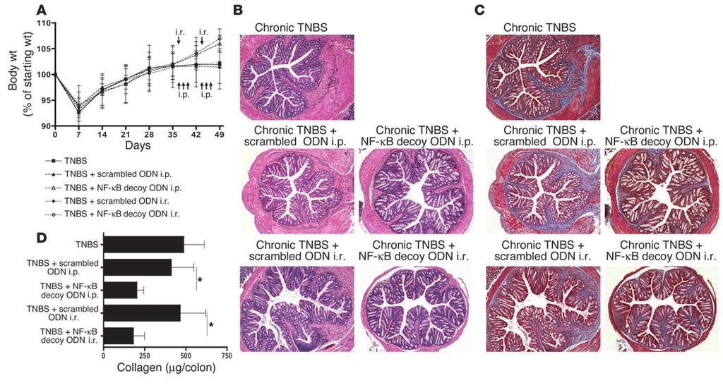 Figure 4 Treatment of chronic TNBS-colitis by NF-κB decoy ODNs. (A D) Chronic TNBS-colitis was induced by 7 weekly i.r. administrations of TNBS in ethanol.