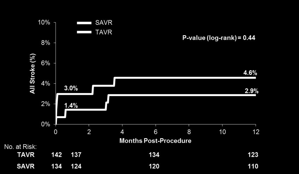 Transcatheter Versus Surgical Aortic Valve Replacement in Patients With Severe Aortic Valve Stenosis: 1-Year Results From the All-Comers 20% NOTION Randomized Clinical Trial All-cause Mortality MI,