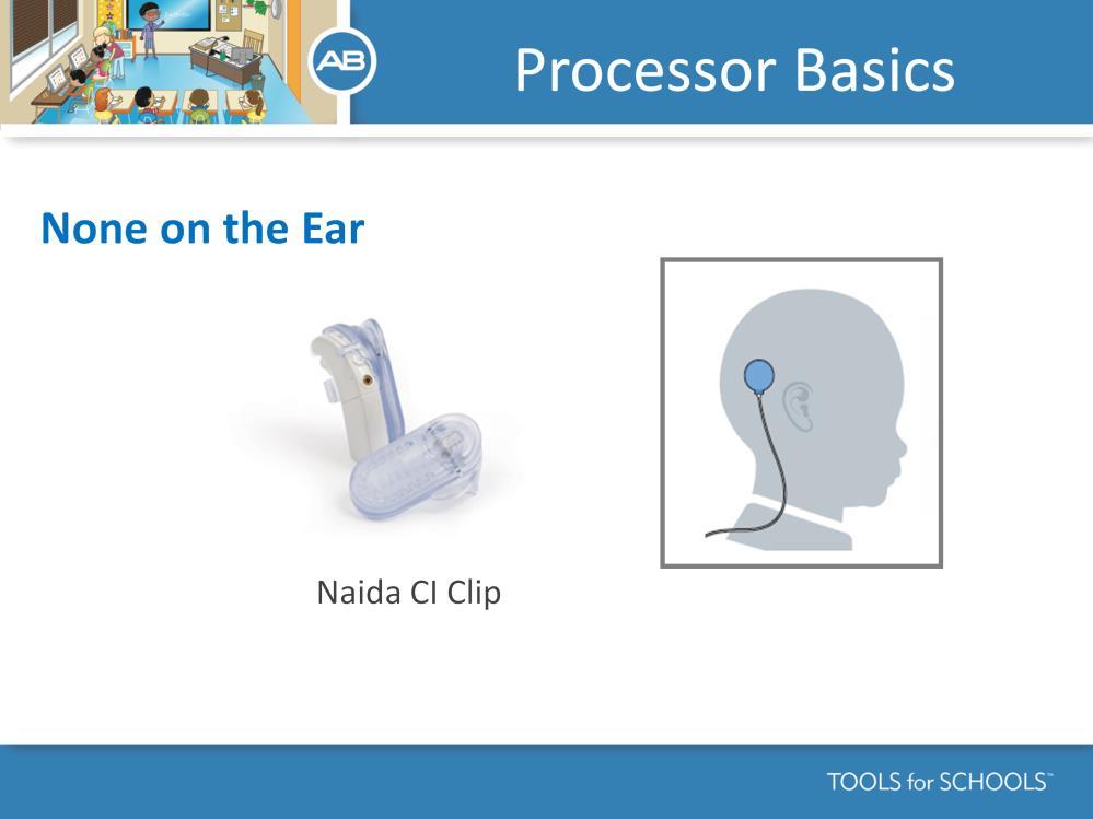 For the NONE ON THE EAR option you will need to use the Naida CI clip and a long headpiece cable.