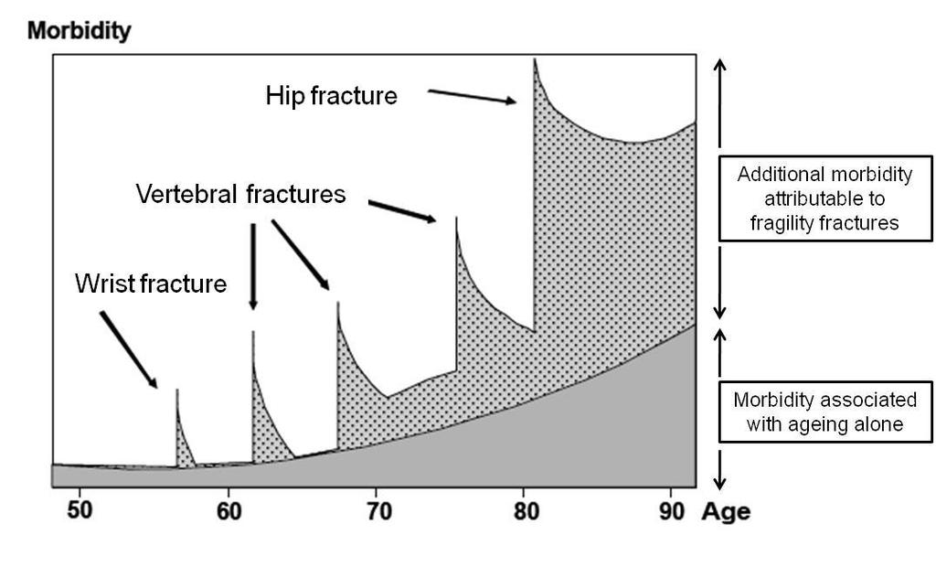 Understanding falls and fragility fractures as longterm conditions 05 October 2011 2.