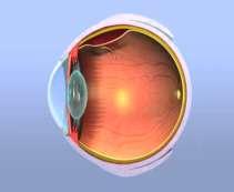 Scleral Buckling Purpose to close retinal breaks & relieve vitreoretinal traction.