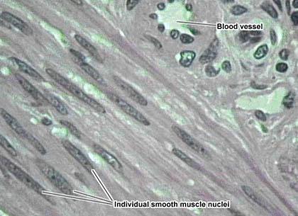 Smooth Muscle No striations Uninucleate spindle shape Involuntary In skin