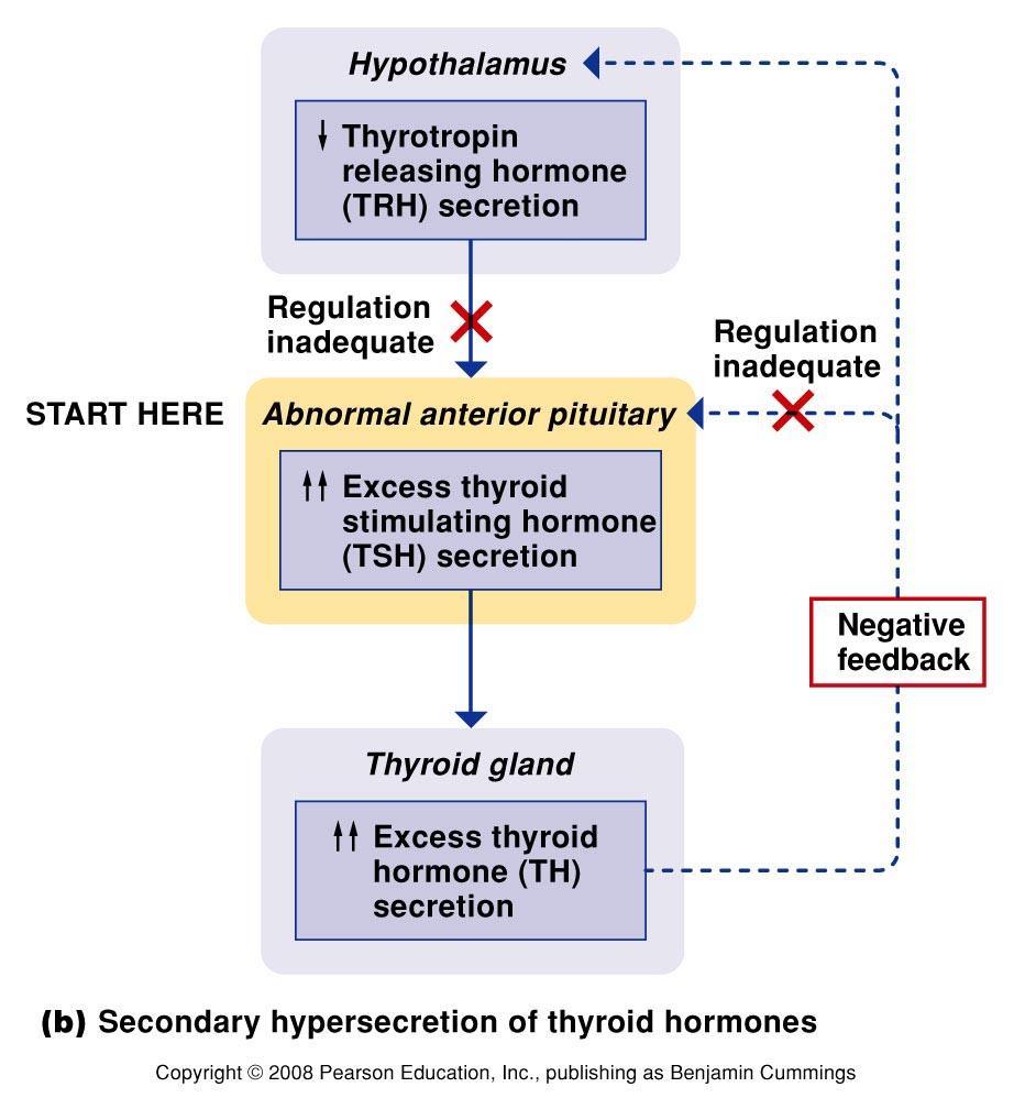Figure 6.13 Abnormal secretion of thyroid hormones. (b) An example of secondary hypersecretion of thyroid hormones.