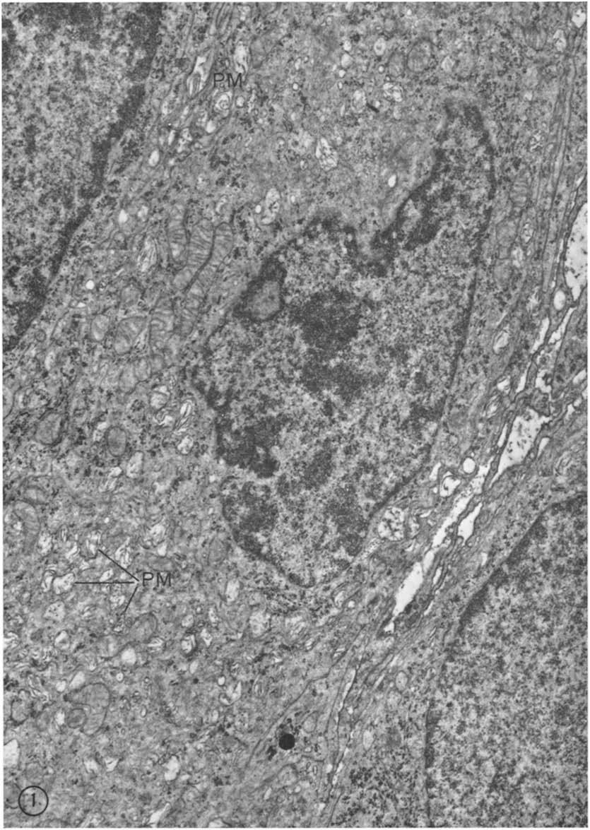 FIGURE 1 The major part of the electron micrograph shows a portion of an albino melanocyte.