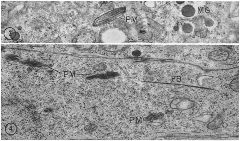 FIG. 3 Electron micrograph showing a premelanosome (PM) in which the fibers of the matrix are arranged parallel to each other. Dense bodies (MG) are the medullary granules. X 29,000.