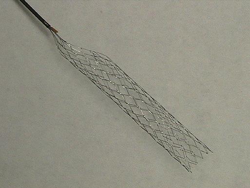 Device The TANBS is a self-expanding, closed-cell nitinol mesh engineered from a laser-cut hypotube in 23-mm and 32-mm lengths, 5 mm in diameter (figure 1).