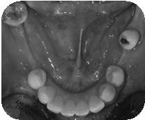 Environment Occlusion Orthodontics TMD The chronic forms of TMD pain may lead to