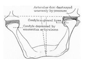 the fossae against the articular disks