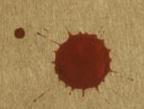 Bloodstain Pattern Analysis Terms Spatter Bloodstains created from the application of force to the area where the blood originated.