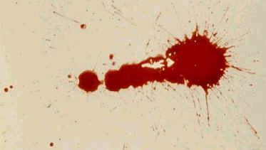 Projected Bloodstains Patterns that occur when a force is applied to the source of the blood Includes low, medium, or high