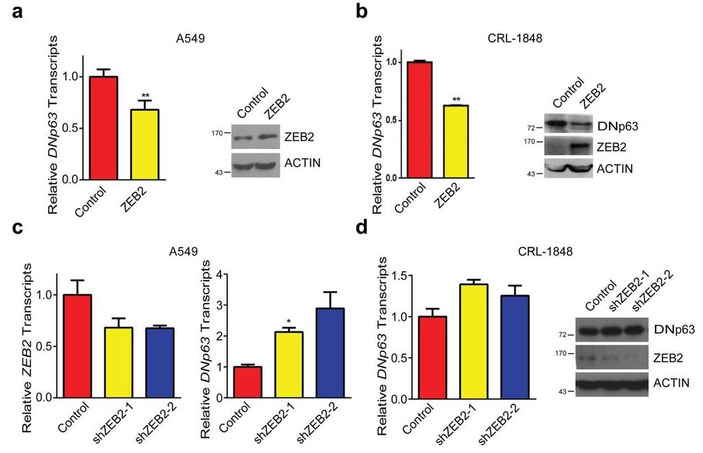 Supplementary Figure 10 ZEB2 represses DNp63 transcription in human lung cancer cell lines.