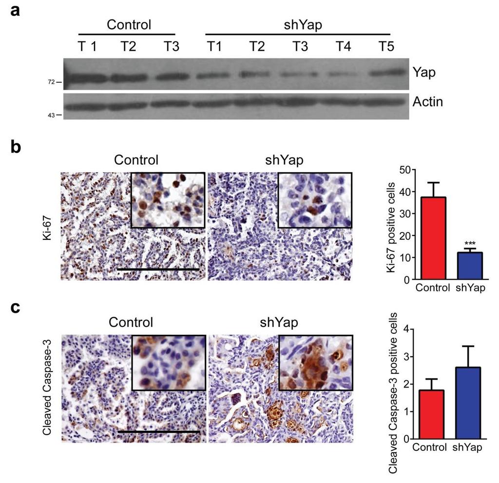 Supplementary Figure 4 Yap knockdown decreases the cell proliferation in lung ADC from KL mouse model.