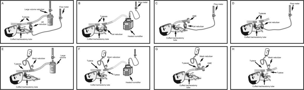 Fig. 3. A D: Experimental setup with jet nebulizer using an unheated (A) and heated humidifier (B), heat-and-moisture exchanger (HME) (C), and room air (D).