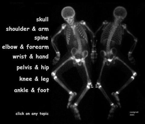 Pectoral girdle, SUPERIEUR ARM AND HAND Danil Hammoudi.