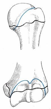 Epiphysial lines of humerus in a young adult. Anterior aspect. The lines of attachment of the articular capsules are in blue.