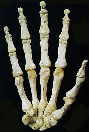 13. Distal Phalange 14. 14. Styloid Process of Ulna Bones of the Right Hand (Palmar Surface) 1. Navicular (Scaphoid) 2. 2. Lunate 3. 3. Triquetral 4.