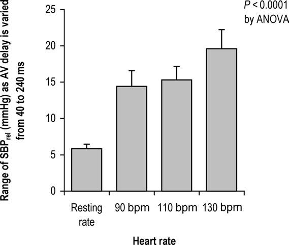362 Z.I. Whinnett et al. Figure 3 Sensitivity of blood pressure to changes in AV delay.
