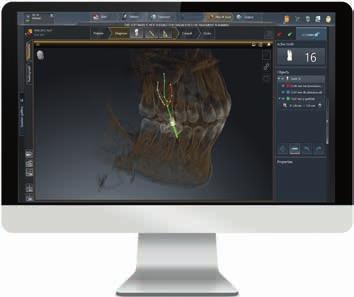 18/19 Unique possibilities In addition to integrated implantology, Sidexis 4 integrates many other time-saving and convenient software solutions.
