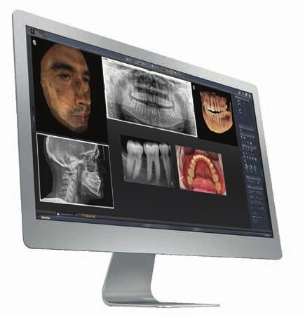 Sidexis 4 is the software for clear diagnoses.