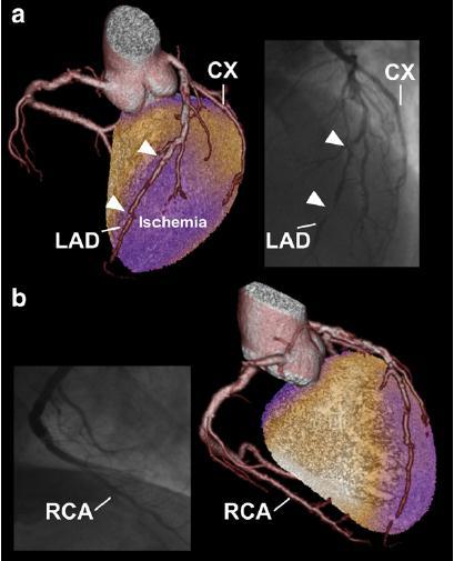 Rapid cardiac hybrid imaging with