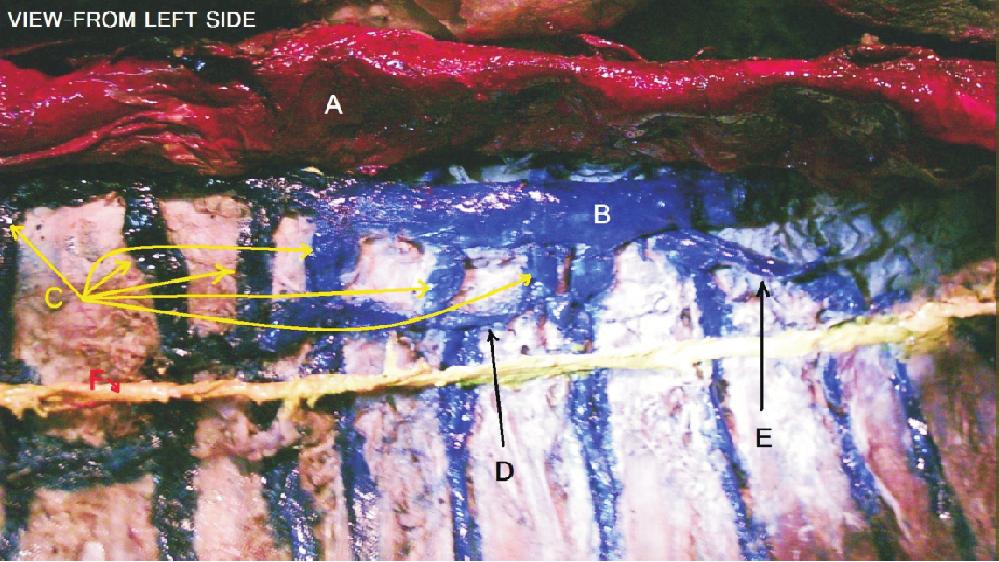 (i) & (ii) = Two nerves, arising from lateral cord of brachial plexus unite to form Musculocutaneous
