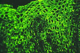 Direct Immunofluorescence: Skin Diagnosis Findings Picture