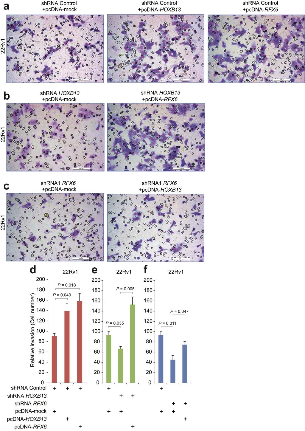 Supplementary Figure 11: RFX6 and HOXB13 play a role in prostate cancer cell proliferation and invasion.