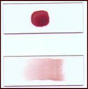 Blood collection in sodium citrate tubes (5-10 ml