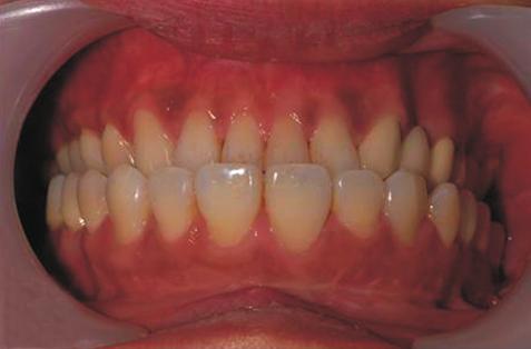 treatment were recommended to correct the jaw deformities.