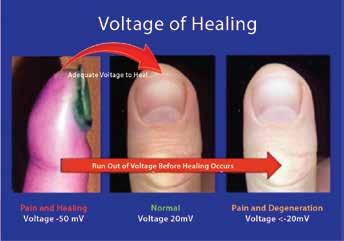 HEALING IS VOLTAGE The Tennant Biomodulator modifies the pathological signal so the brain becomes aware of inputting the electrical impulses to increase voltage.