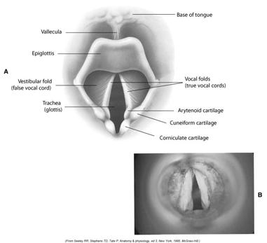 2. Arytenoid cartilage 3. Cervical trachea 6. Epiglottic larynx 7. Epiglottis 8. False Vocal Cords 9. Hyoid Bone 12.