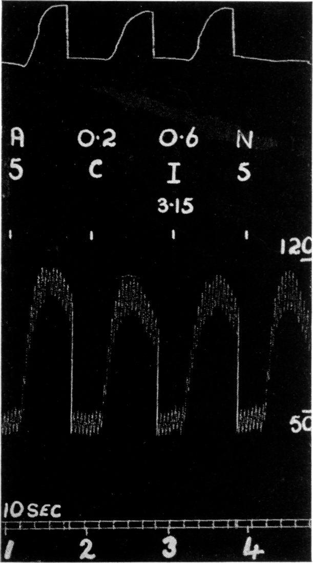 INSULIN AND RABBIT SUPRARENALS 291.- 010 cl cs 61 Time in hours FIG. 1 FIG. 2 FIG. 1.-Spinal cat. Normal nictitating membrane and blood pressure. (1) 5 tog. I-adrenaline; (2) 0.2 ml.