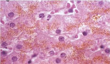 hepatocytes (A). 2.