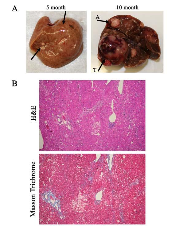 Figure 38. Gross histology and representative cellular morphology of HCC in aging Alb:Hdac3 fl/- mice. A. Representative livers of 5-month (left panel) and 10-month (right panel) Alb:Hdac3 fl/- mice.