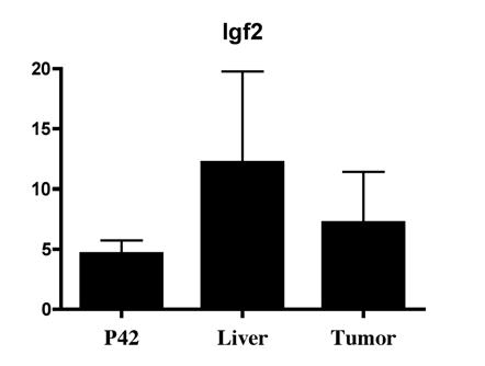 Figure 41. Expression levels of HCC molecular markers are increased in Hdac3-null liver.