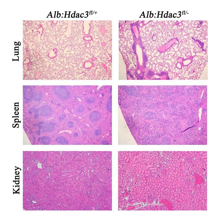 Figure 42. Peripheral organs are affected in Alb:Hdac3 fl/- mice which develop HCC. Histological H&E analysis of lung, spleen and kidney from Alb:Hdac3 fl/- mice.