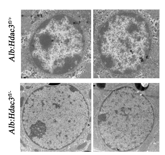 Figure 33. Nuclei of Hdac3-null cells have decreased amounts of heterochromatin.