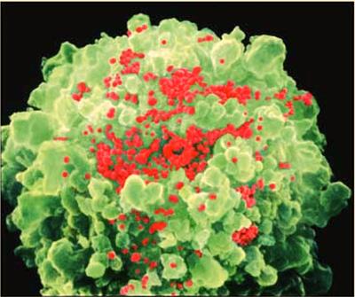 Virus and Prokaryotic Gene Regulation - 8 HIV A Human Retrovirus HIV is a retrovirus. Infection with HIV to date has been generally fatal, and the infection rate is, worldwide, increasing.