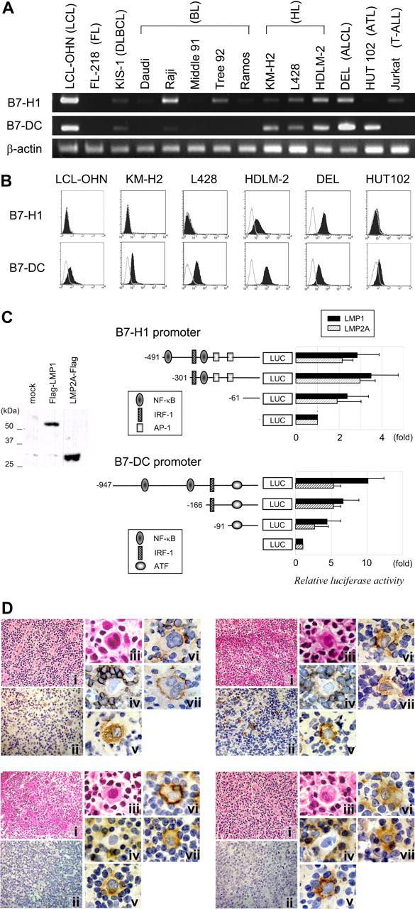 Expression and gene regulation of PDL-1 (CD273) and PDL-2 (CD274) in Hodgkin Lymphoma Expression of PDL1/PDL2 in HL cell lines LMP1 and LMP2A