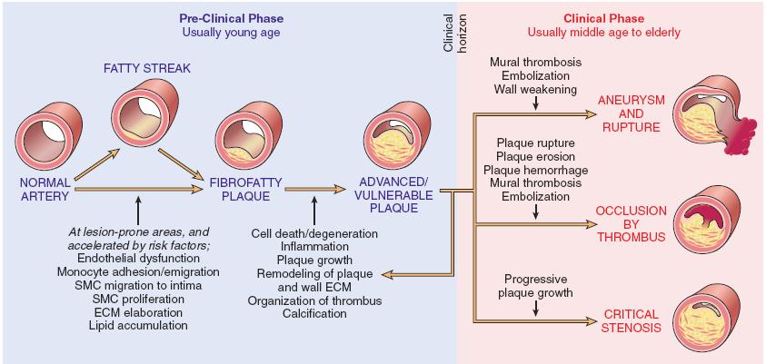 ATHEROSCLEROSIS Clinical Consequences: Plaque erosion or rupture typically triggers