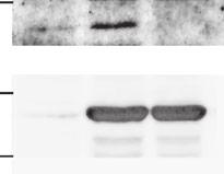 (1 μg) or (1 μg) and (1 μg) for 2 h, and purified (P) with an immobilized anti- antibody. Immune complexes and TCL were analyzed by immunoblot (WB) as indicated.