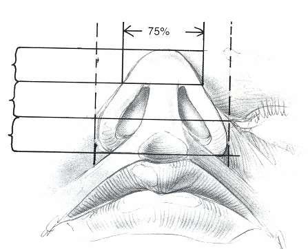 Facial Analysis-The Nose Submental vertex view: equilateral