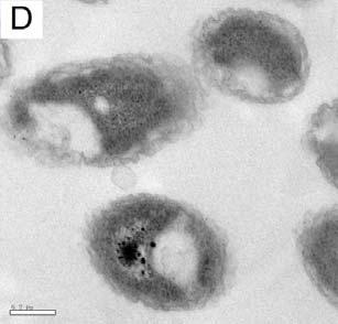 TEM Cell irregular sunken Cytoplasmic density not