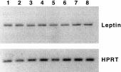 198 R Peinó and others EUROPEAN JOURNAL OF ENDOCRINOLOGY (2000) 142 Figure 2 Agarose gel (2%) stained with ethidium bromide showing PCR products obtained using specific primers for the ob gene.